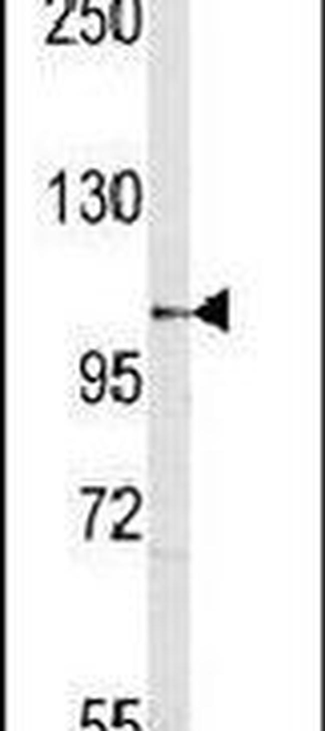 SEMA5A Antibody in Western Blot (WB)