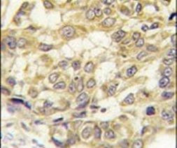 SEMA3E Antibody in Immunohistochemistry (IHC)
