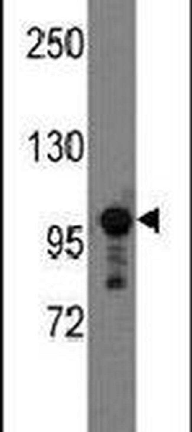 SEMA5A Antibody in Western Blot (WB)