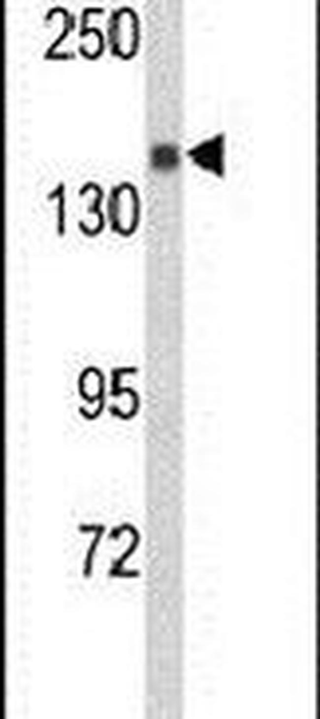 SEMA5A Antibody in Western Blot (WB)