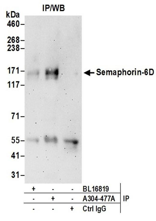 Semaphorin-6D Antibody in Western Blot (WB)