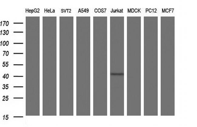 Septin 1 Antibody in Western Blot (WB)