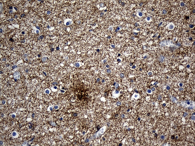 Septin 3 Antibody in Immunohistochemistry (Paraffin) (IHC (P))
