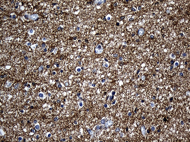 Septin 3 Antibody in Immunohistochemistry (Paraffin) (IHC (P))