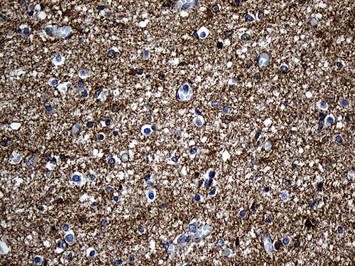 Septin 3 Antibody in Immunohistochemistry (Paraffin) (IHC (P))