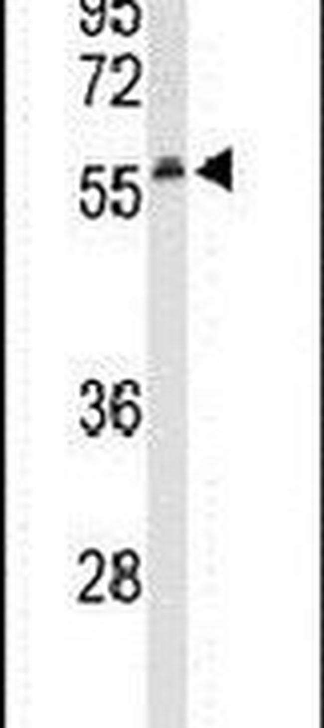 SESN1 Antibody in Western Blot (WB)