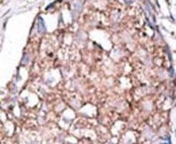 SIGLEC7 Antibody in Immunohistochemistry (IHC)