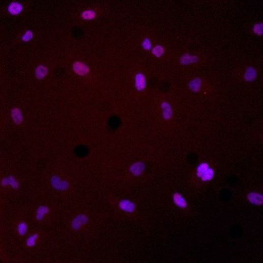 Smad4 Antibody in Immunocytochemistry (ICC/IF)