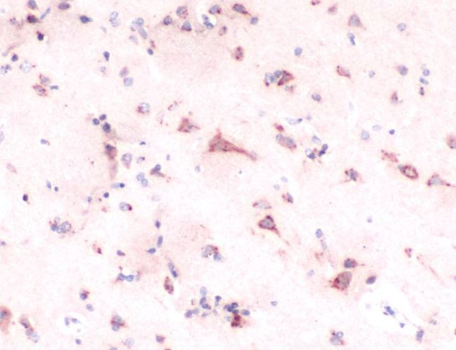 SCN1A Antibody in Immunohistochemistry (IHC)