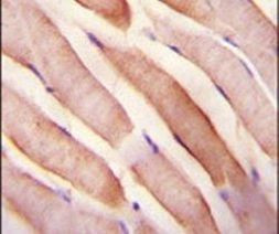 STC2 Antibody in Immunohistochemistry (IHC)