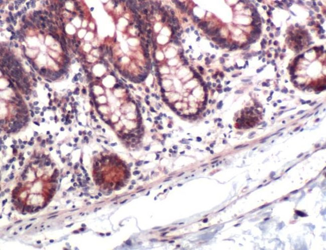 STC2 Antibody in Immunohistochemistry (IHC)