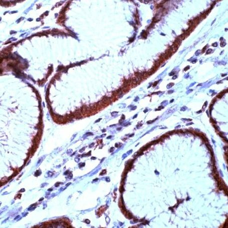 Survivin Antibody in Immunohistochemistry (IHC)