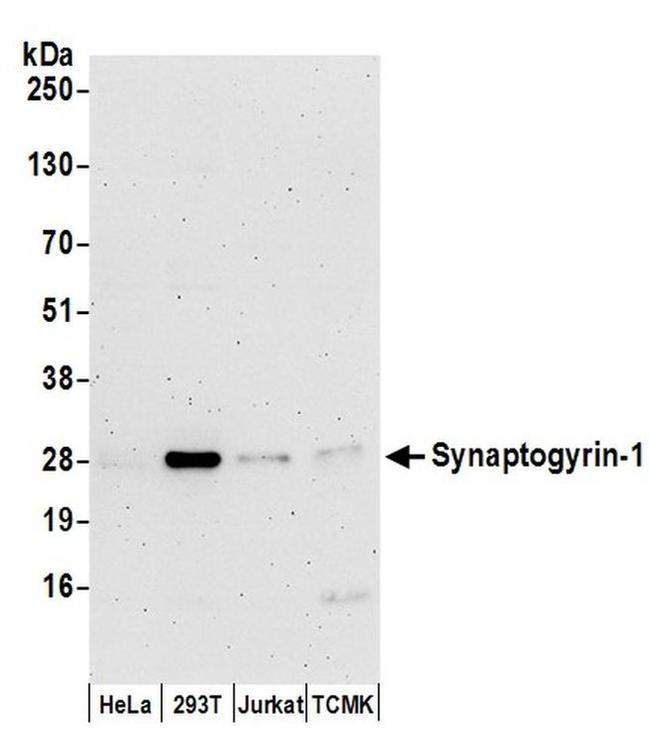 Synaptogyrin-1 Antibody in Western Blot (WB)