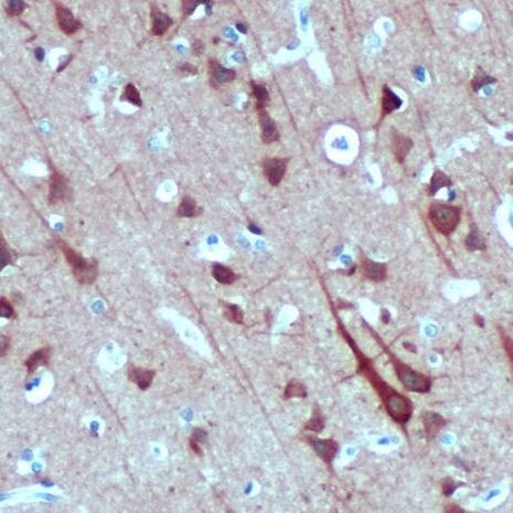 Syntaxin 1 Antibody in Immunohistochemistry (IHC)