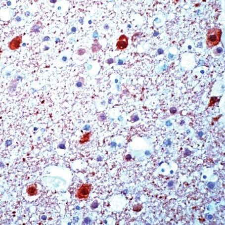 beta Synuclein Antibody in Immunohistochemistry (IHC)