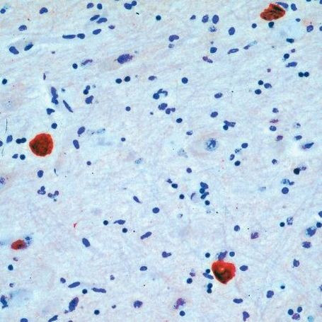 pan Synuclein Antibody in Immunohistochemistry (IHC)