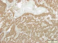 Synaptophysin Antibody in Immunohistochemistry (IHC)