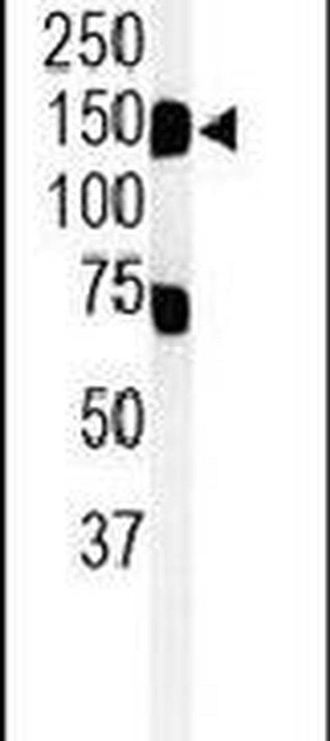 KIAA0922 Antibody in Western Blot (WB)