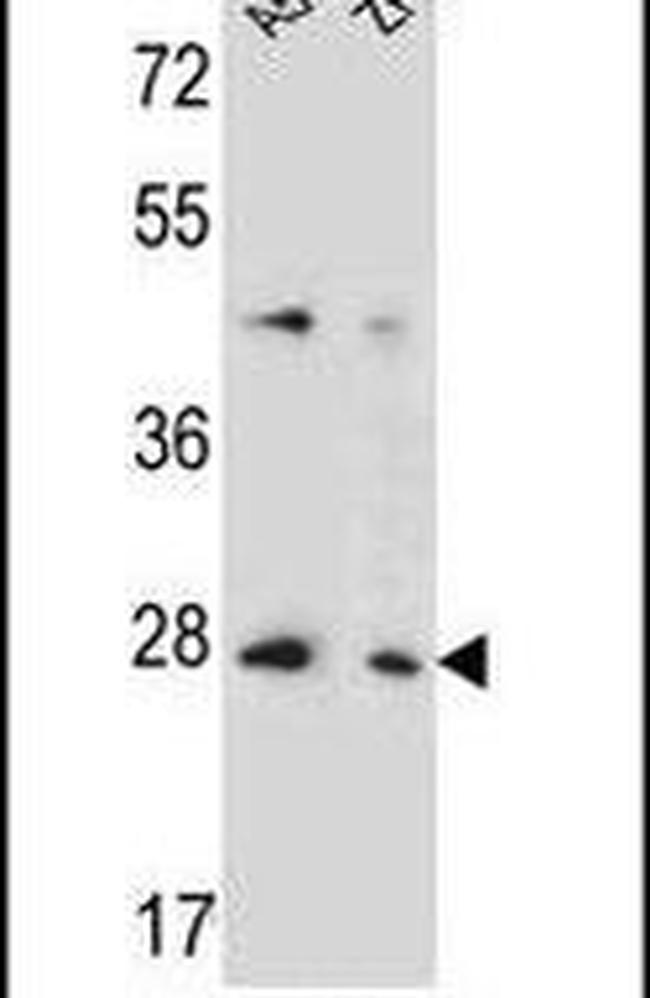 TM4SF4 Antibody in Western Blot (WB)