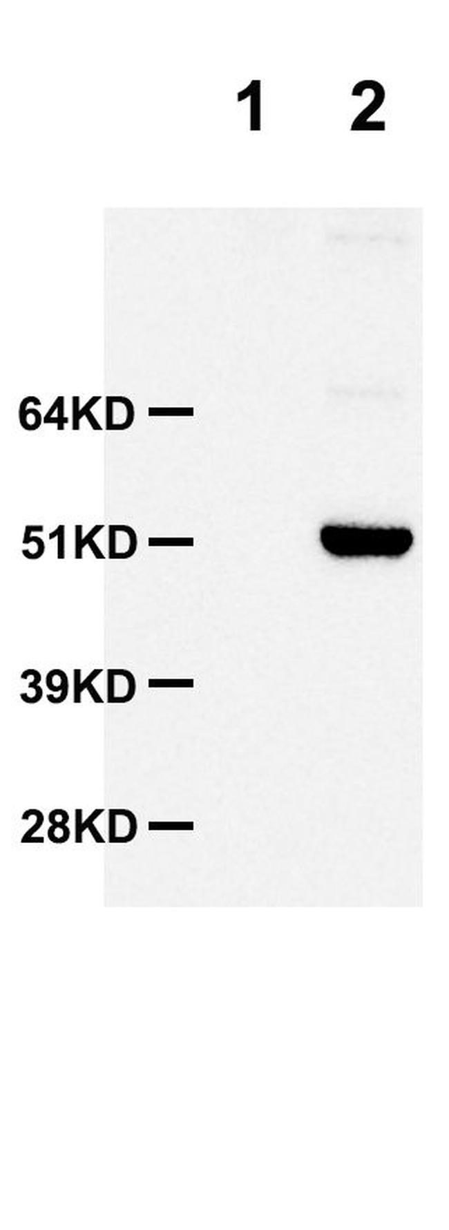 SARS-CoV-2 N Protein Chimeric Antibody in Western Blot (WB)