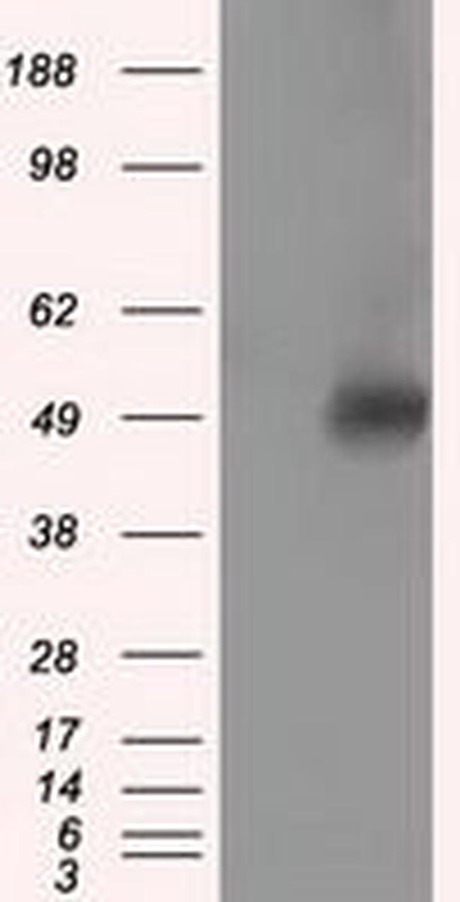 VAT1L (KIAA1576) Antibody in Western Blot (WB)