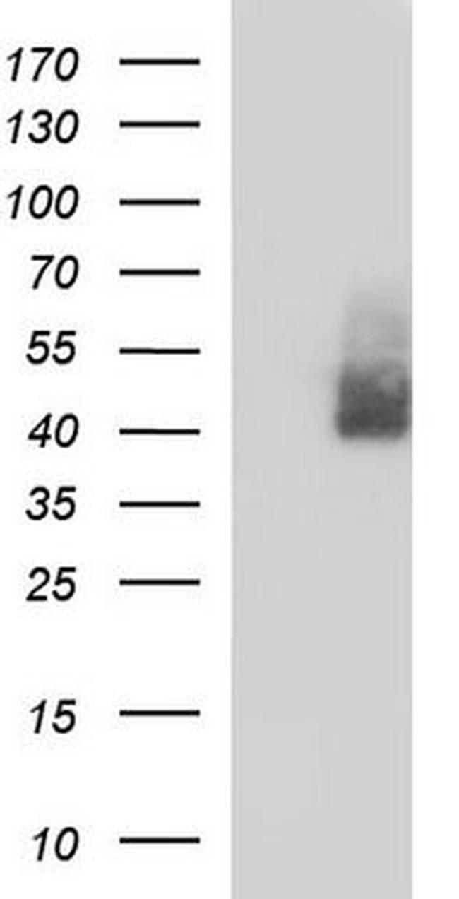 Endothelin B Receptor Antibody in Western Blot (WB)