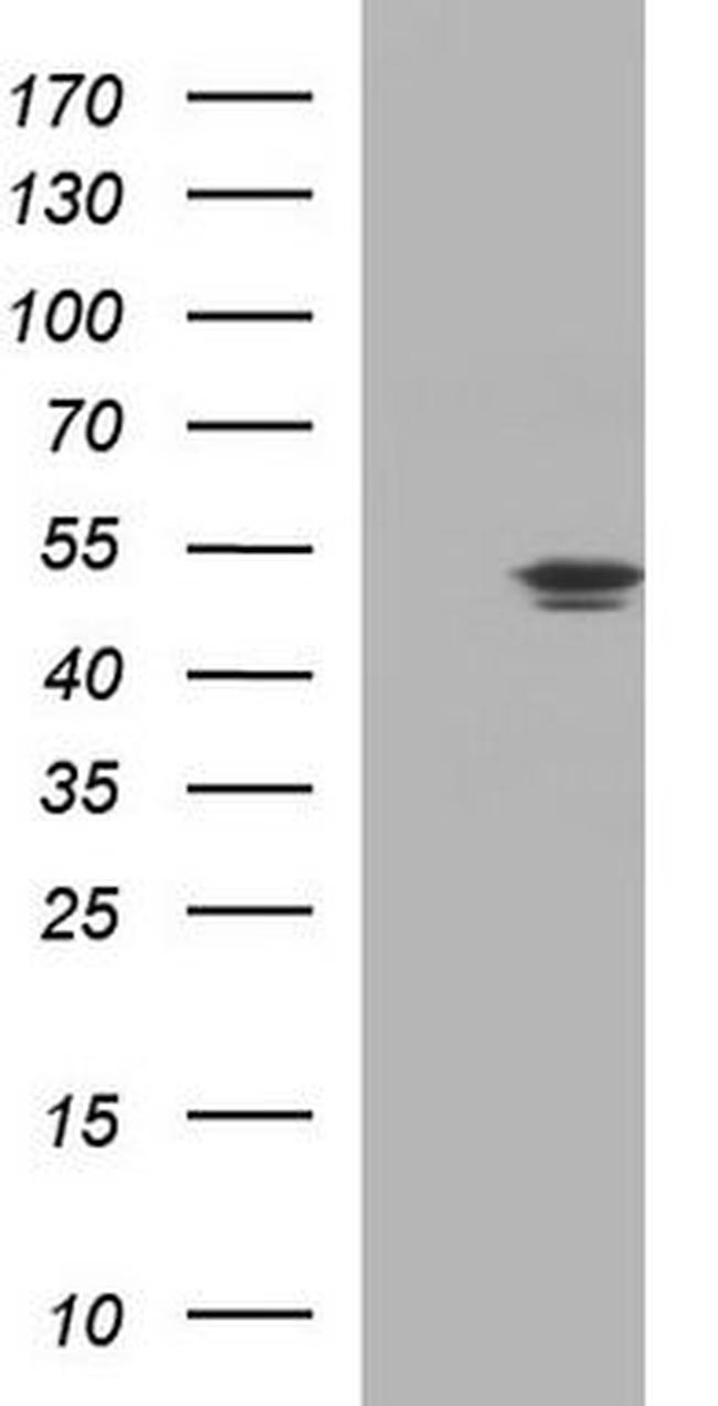 Fumarase Antibody in Western Blot (WB)
