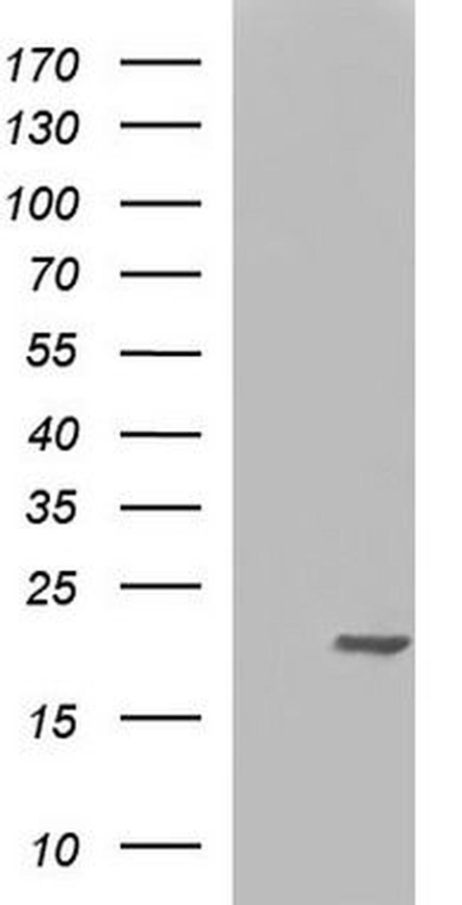 nm23-H1 Antibody in Western Blot (WB)