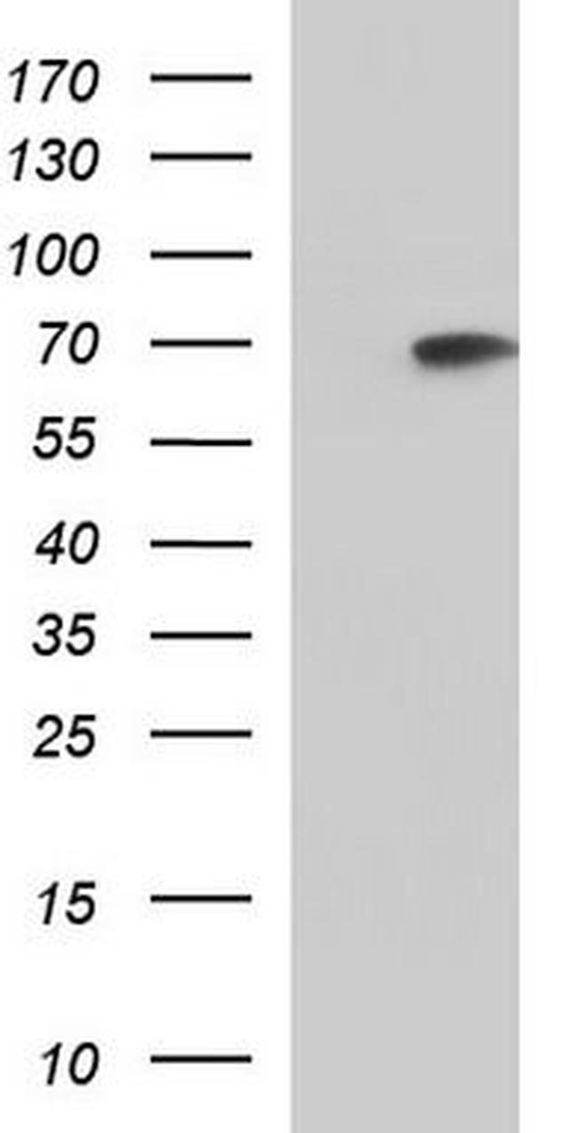XPD Antibody in Western Blot (WB)