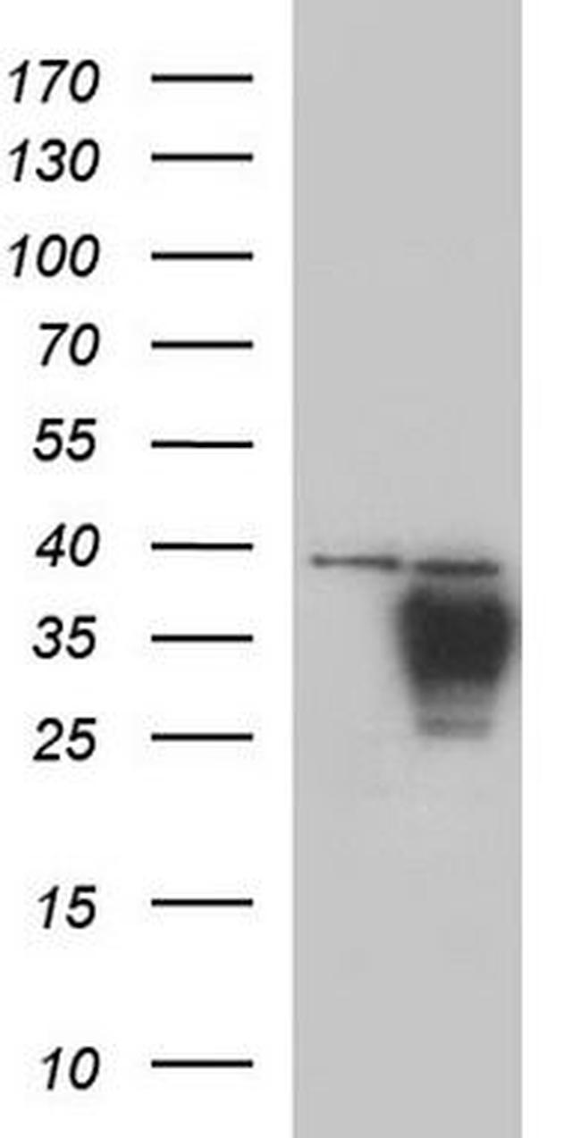 Alpha 1 Acid Glycoprotein Antibody in Western Blot (WB)