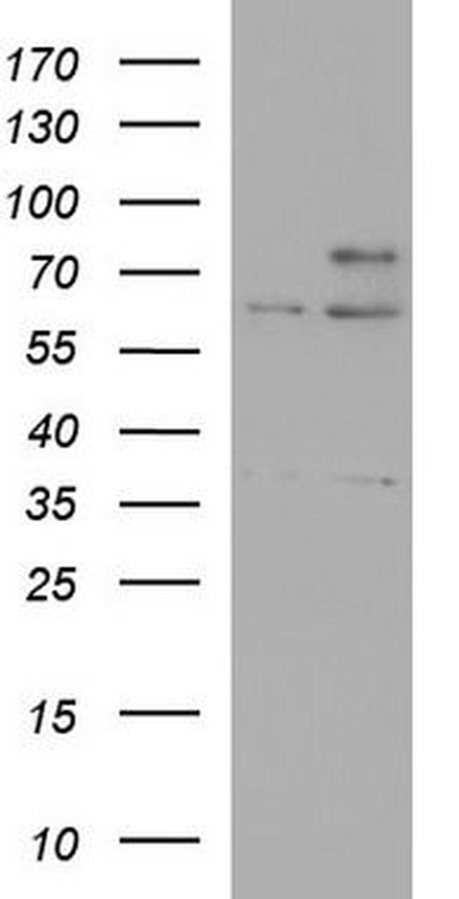 CD10 Antibody in Western Blot (WB)