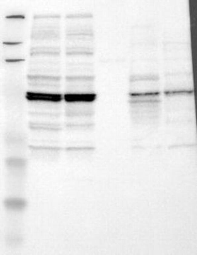 CXCR4 Antibody in Western Blot (WB)