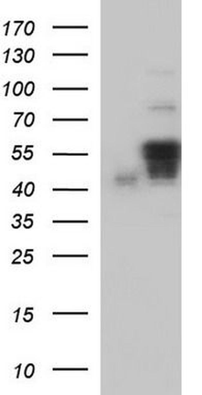 Annexin A7 Antibody in Western Blot (WB)