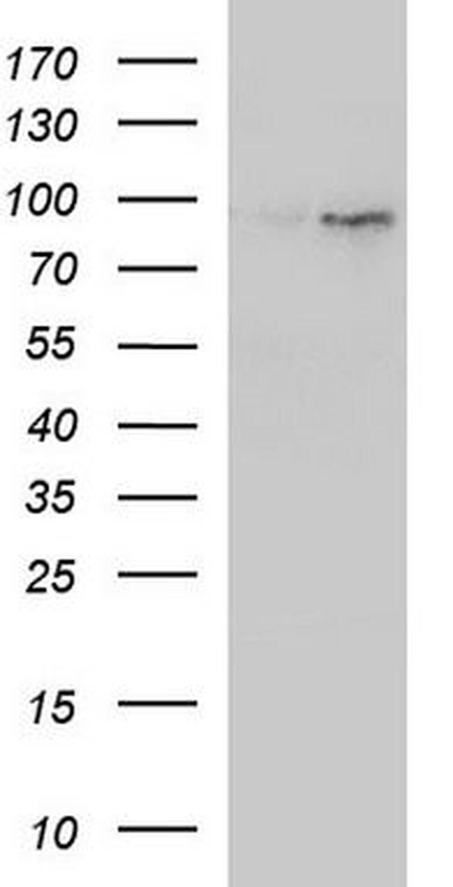 IL12RB2 Antibody in Western Blot (WB)