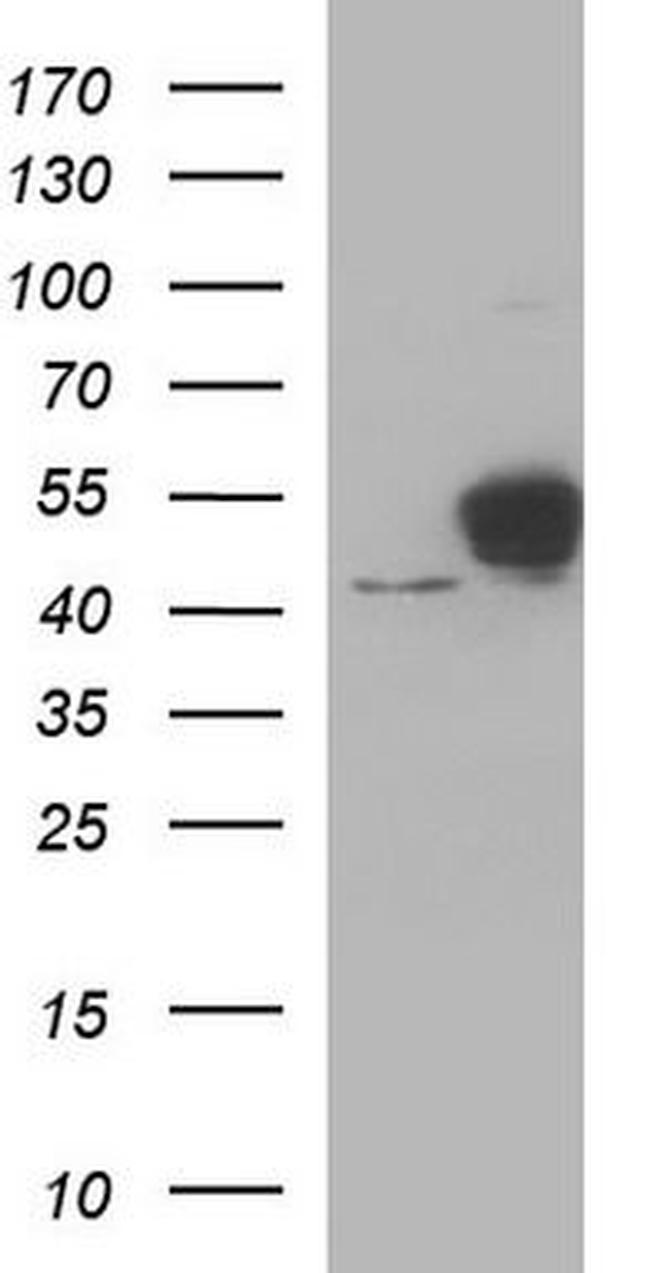 NSE Antibody in Western Blot (WB)