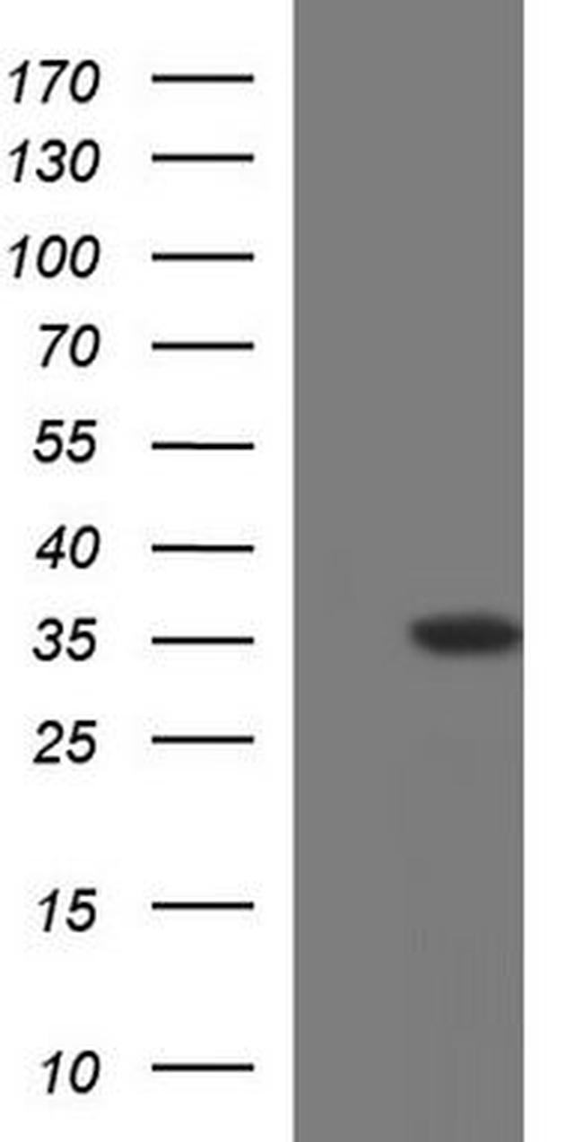 GCLM Antibody in Western Blot (WB)