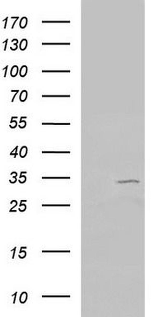 GNB2 Antibody in Western Blot (WB)