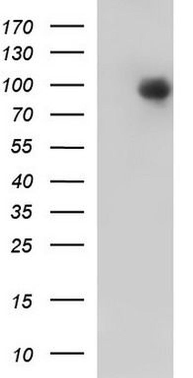 PKC epsilon Antibody in Western Blot (WB)