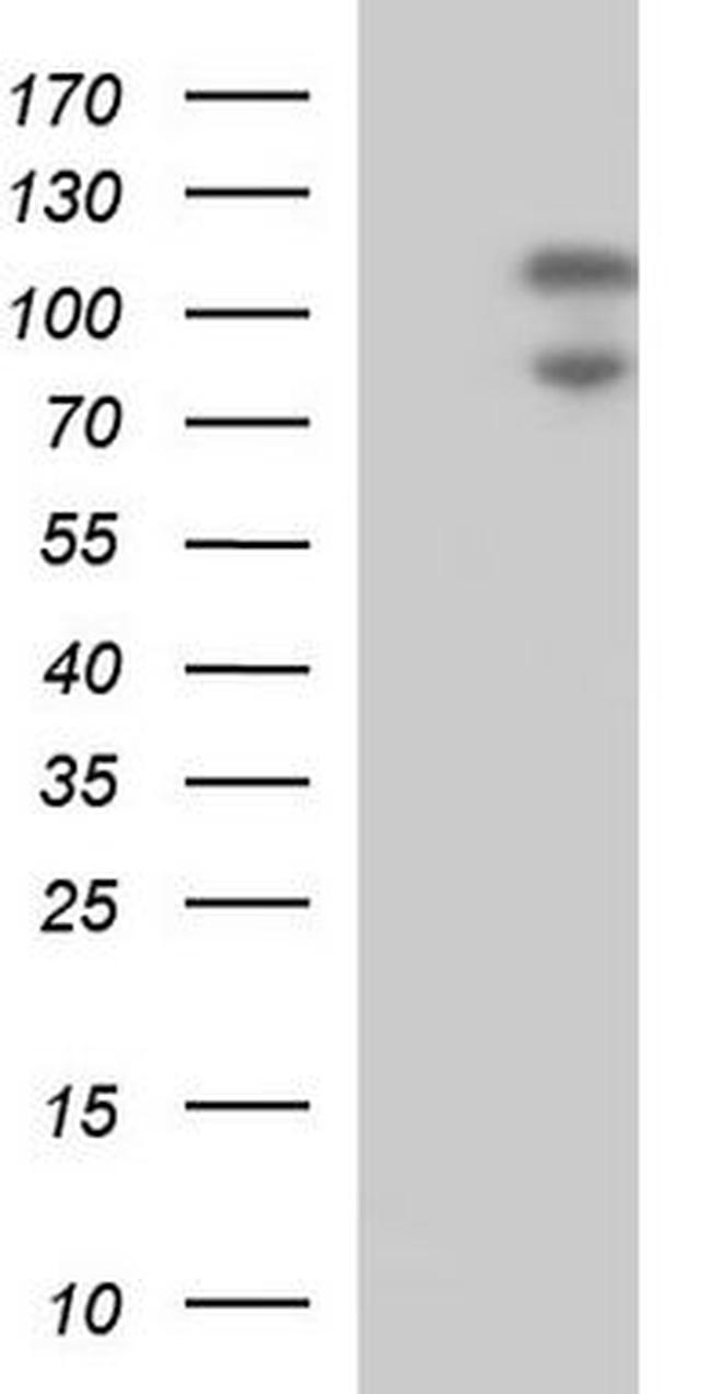 Lipin 2 Antibody in Western Blot (WB)