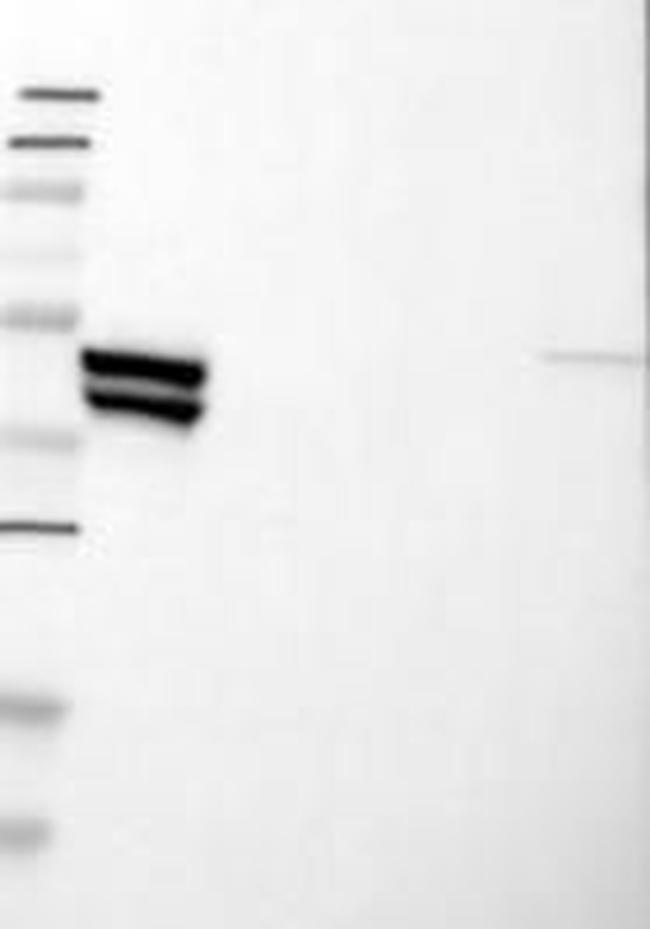 KRT23 Antibody in Western Blot (WB)