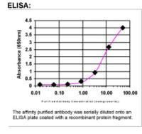 TRPV6 Antibody in ELISA (ELISA)
