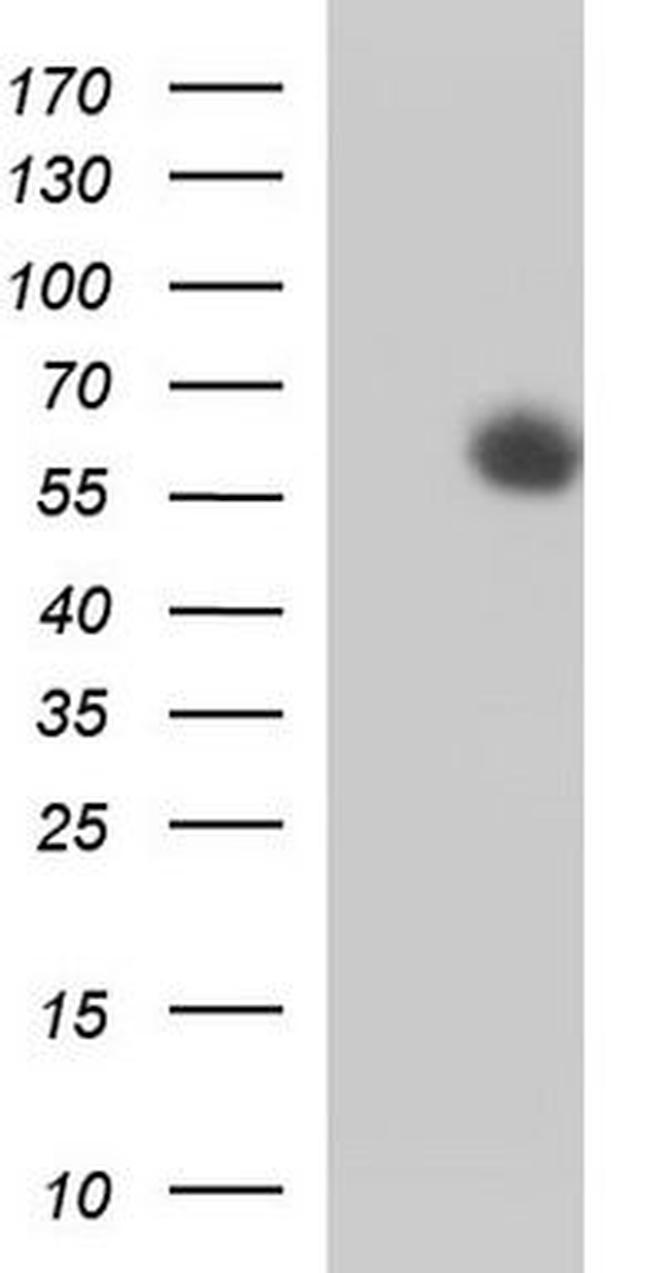 MCSF Antibody in Western Blot (WB)