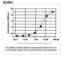 Fibronectin Antibody in ELISA (ELISA)