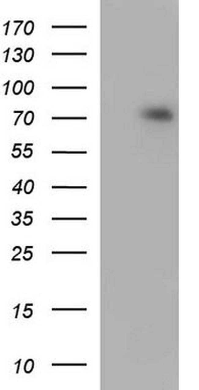 CACNB2 Antibody in Western Blot (WB)
