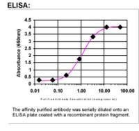 EGFR Antibody in ELISA (ELISA)