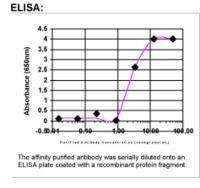 EGFR Antibody in ELISA (ELISA)