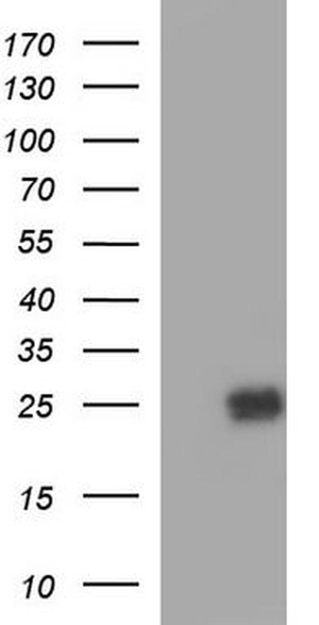 Peroxiredoxin 2 Antibody in Western Blot (WB)