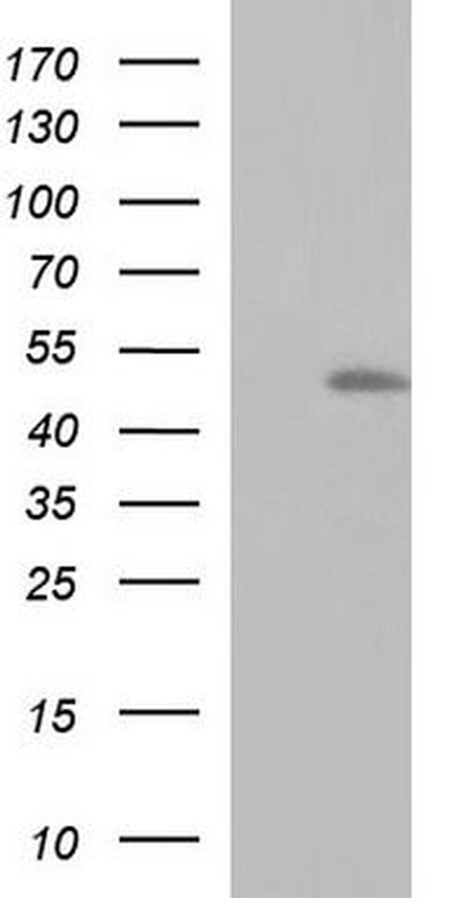 RNF39 Antibody in Western Blot (WB)