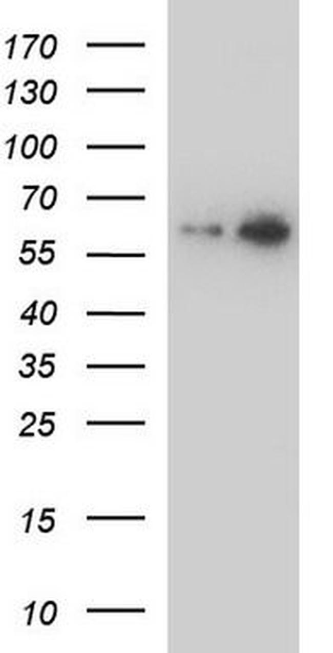 ALDH4A1 Antibody in Western Blot (WB)