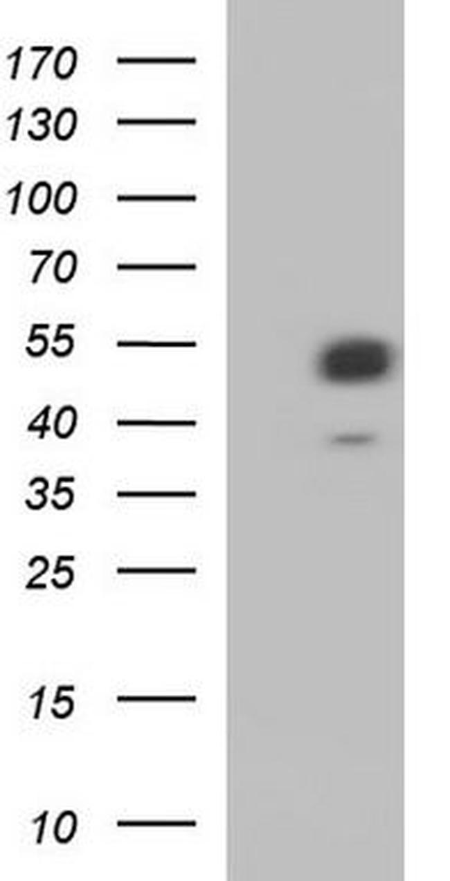WTAP Antibody in Western Blot (WB)